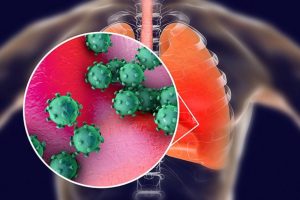 ‘कोभिड १९’ बाट विश्वभर नौ लाख २९ हजारभन्दा बढीको मृत्यु